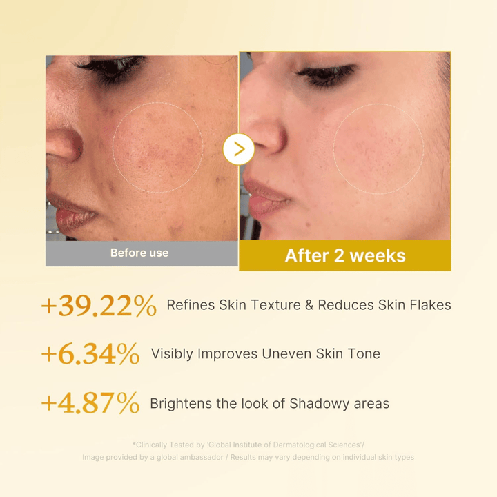 Before-and-after image for Medicube Kojic Acid Turmeric Resurfacing Toner showing improved skin texture, more even skin tone, and reduced dry skin flakes after two weeks of use.